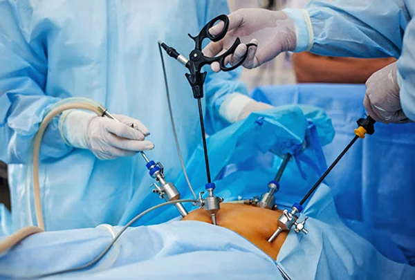 Gastroenterology Surgery