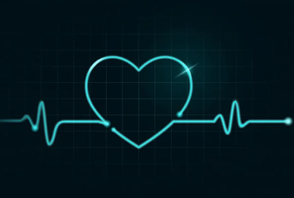 ECG