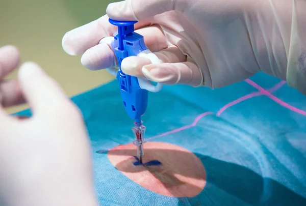 Tissue Biopsy