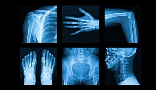 X-Ray Tests